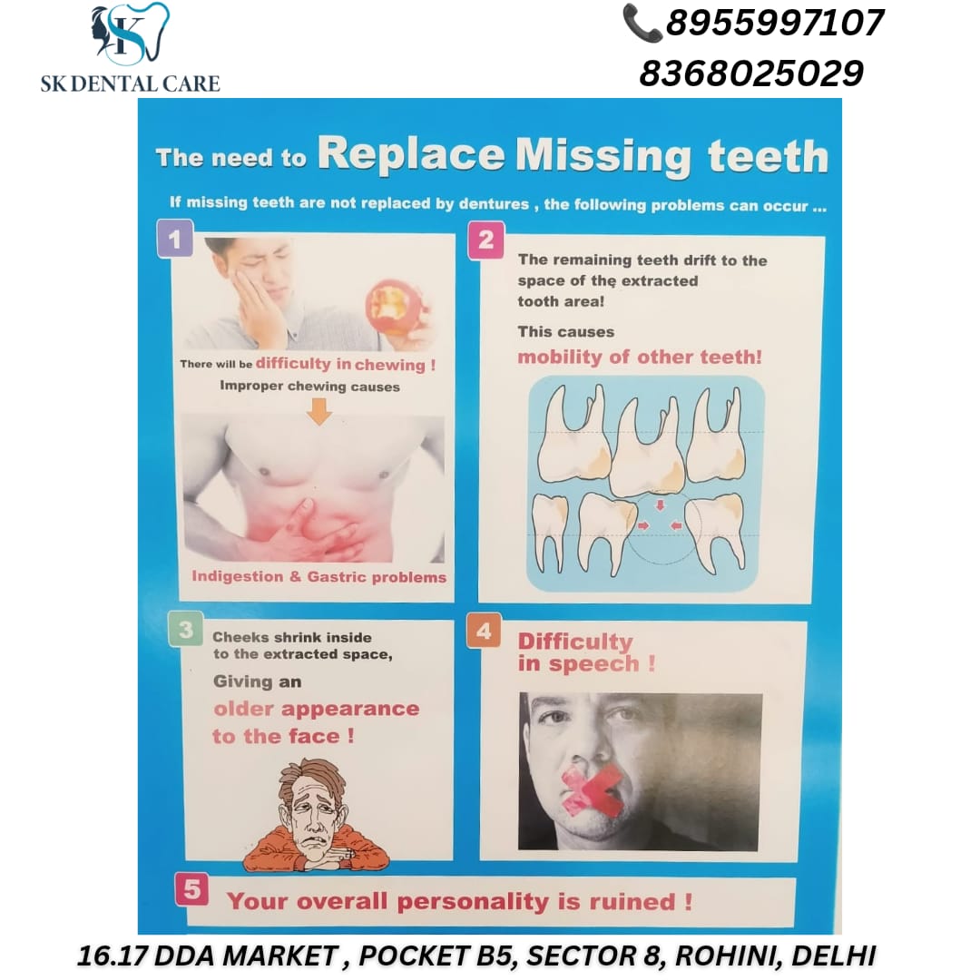 Replace Missing Teeth